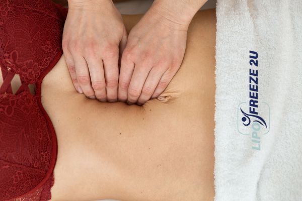 diastasis recti treatment Thrapston