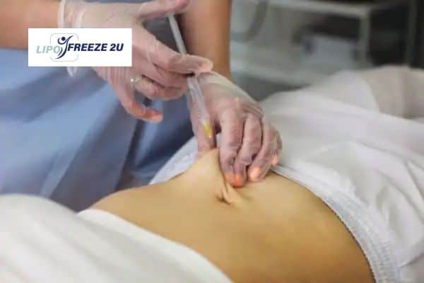 How Does Aqualyx Fat Dissolving Injection Work to Break Down Fat Thrapston?
