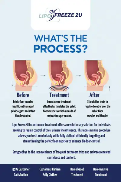 Diagram of how incontinence treatment Thrapston works.