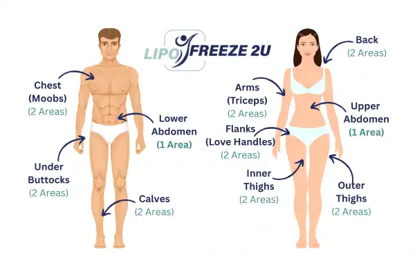 Areas you can have fat freezing treatment Thrapston